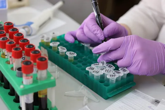 Lila gumikesztyűt viselő személy laboratóriumi mintacsöveket jelöl fixfilccel egy zöld műanyag mintatartó állványban; a háttérben vörös kupakos vérvételi csövek láthatók egy másik állványban.